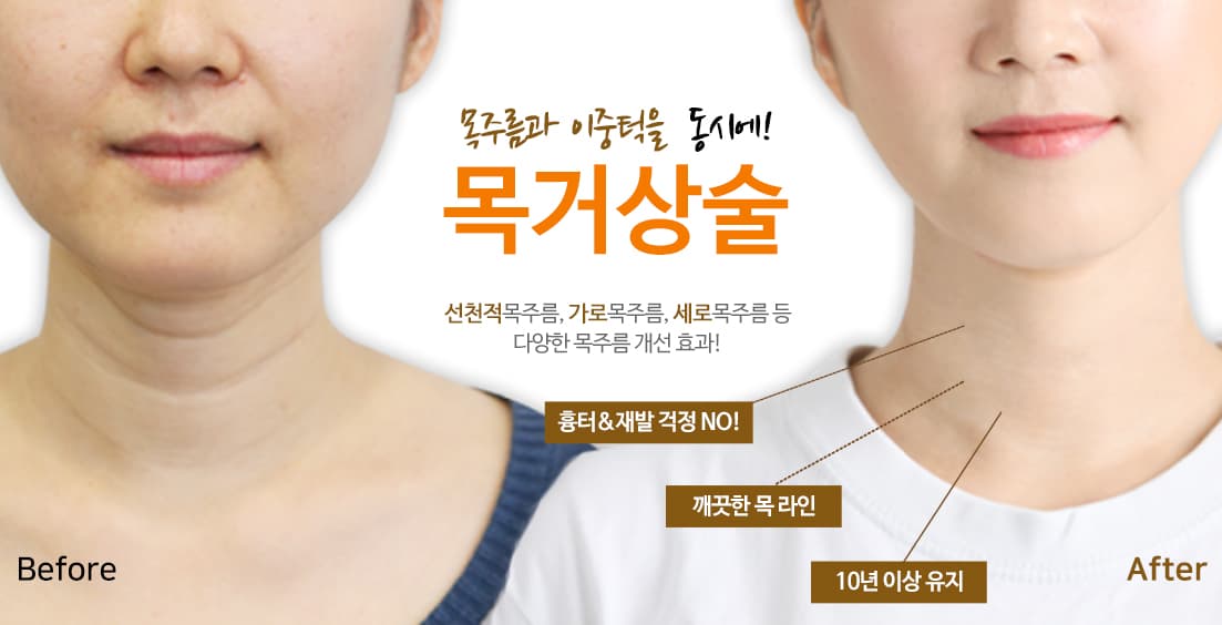 노블와이 성형외과 메인 슬라이드 4