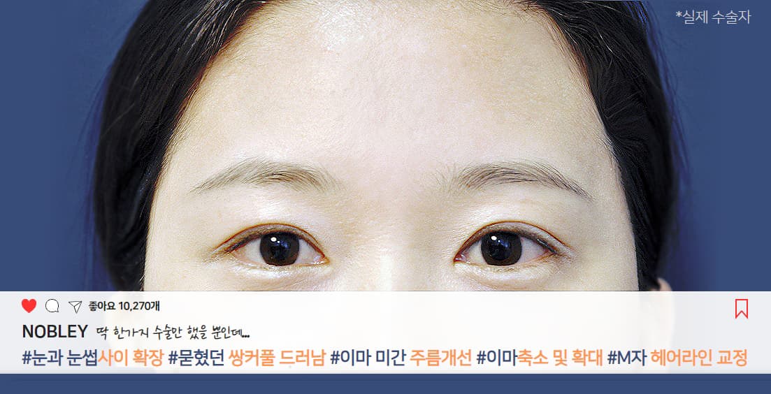 노블와이 성형외과 메인 슬라이드 5