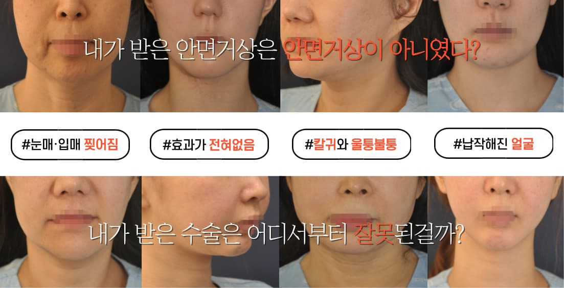 노블와이 성형외과 메인 슬라이드 9